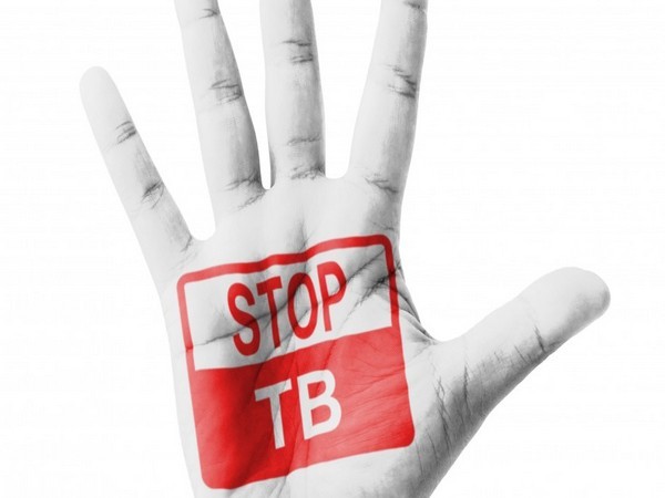 This year's theme for World TB Day: 'The Clock is Ticking'
