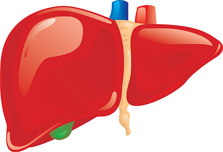 Nonalcoholic fatty liver disease (NAFLD): a Growing epidemic