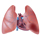 Pulmonary Embolism