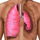 Pneumothorax