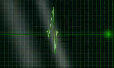 Electrocardiogram