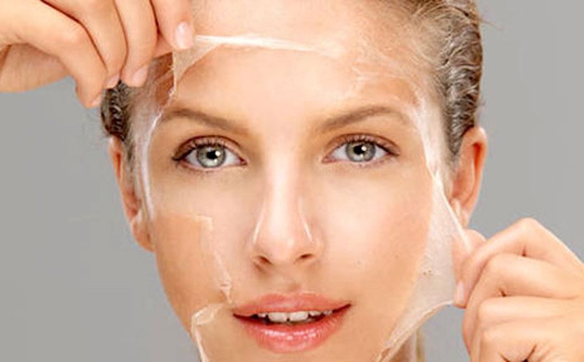 All About Chemical Peels