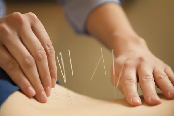 How to Become an Acupuncturist?